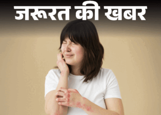 आप भी हैं खुजली से परेशान, इसे न करें नजरअंदाज:  हो सकता है एक्जिमा, डाॅक्टर से जानें इसके कारण, लक्षण और बचाव के तरीके