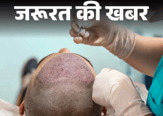 जरूरत की खबर- हेयर ट्रांसप्लांट के बाद 2 की मौत:  क्या ये सर्जरी वाकई सेफ, कब हो सकती है खतरनाक, ये 7 सावधानियां जरूरी