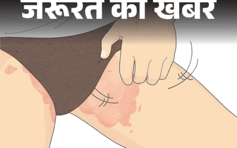 जरूरत की खबर- बारिश-उमस में बढ़ती थाई रैशेज की समस्या:  इन 7 कारणों से होते रैशेज, डॉक्टर से जानें बचाव के लिए 8 जरूरी सावधानियां
