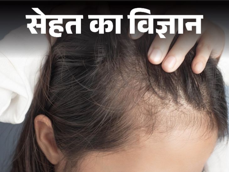 सेहत का विज्ञान- हेयरफॉल सिर्फ जेनेटिक नहीं होता:  40 के बाद बाल क्यों बदलने लगते हैं? जानिए बचाव के तरीके