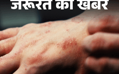 जरूरत की खबर- मानसून में बढ़ रहा स्किन इन्फेक्शन: नमी से बढ़ता बैक्टीरियल और फंगल इंफेक्शन, जानें बचाव और इलाज के टिप्स जरूरत की खबर- मानसून में बढ़ रहा स्किन इन्फेक्शन: नमी से बढ़ता बैक्टीरियल और फंगल इंफेक्शन, जानें बचाव और इलाज के टिप्स