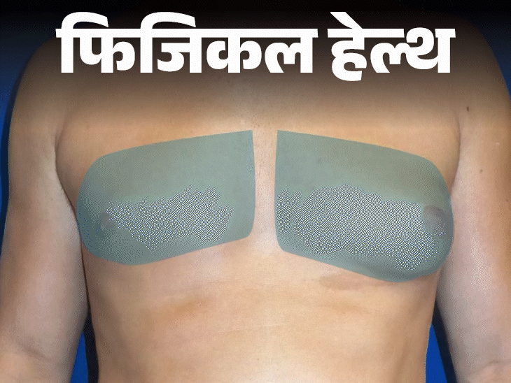 फिजिकल हेल्थ- पुरुषों के सीने पर स्तन जैसा उभार: क्या है गाइनेकोमेस्टिया, डॉक्टर से जानें किसे हो सकती है ये समस्या, कैसे बचें फिजिकल हेल्थ- पुरुषों के सीने पर स्तन जैसा उभार: क्या है गाइनेकोमेस्टिया, डॉक्टर से जानें किसे हो सकती है ये समस्या, कैसे बचें