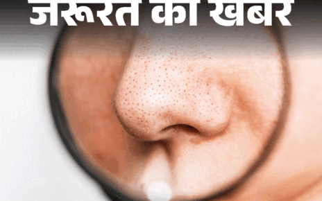 जरूरत की खबर- क्या आपके चेहरे पर हैं ब्लैकहेड्स:  हो सकते हैं ये 6 कारण, डर्मेटोलॉजिस्ट से जानें छुटकारा पाने के 10 टिप्स