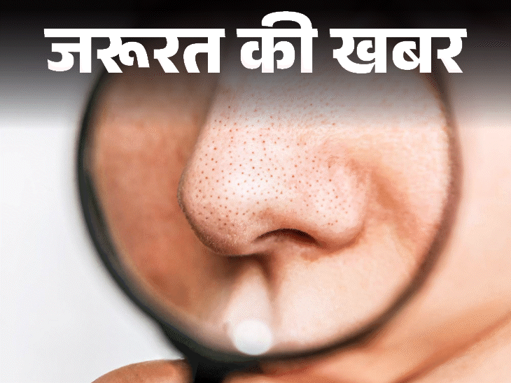 जरूरत की खबर- क्या आपके चेहरे पर हैं ब्लैकहेड्स:  हो सकते हैं ये 6 कारण, डर्मेटोलॉजिस्ट से जानें छुटकारा पाने के 10 टिप्स