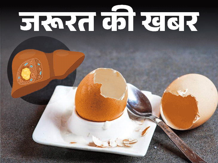 जरूरत की खबर- खराब अंडे से लिवर एब्सेस का रिस्क:  जानें क्या है ये बीमारी, कितनी खतरनाक, सही और खराब अंडे की पहचान कैसे करें
