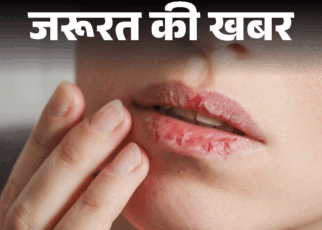 जरूरत की खबर- सर्दियों में क्यों फटते हैं होंठ:  डर्मेटोलॉजिस्ट से जानें कारण और बचाव के तरीके, विंटर लिप्स केयर के 15 टिप्स