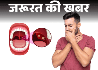 जरूरत की खबर- गले में दर्द हो सकता है टॉन्सिलाइटिस:  डॉक्टर से जानें ये क्या है, क्यों होता है, लक्षण और बचाव की जरूरी सावधानियां