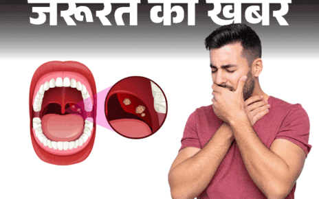 जरूरत की खबर- गले में दर्द हो सकता है टॉन्सिलाइटिस:  डॉक्टर से जानें ये क्या है, क्यों होता है, लक्षण और बचाव की जरूरी सावधानियां