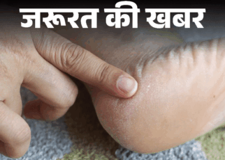 जरूरत की खबर- सर्दियों में फटती हैं एड़ियां:  डर्मेटोलॉजिस्ट से जानें कैसे करें ठीक, क्रैक्ड हील्स को मुलायम बनाने के 9 स्टेप्स
