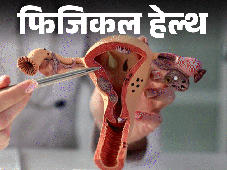 फिजिकल हेल्थ- बार–बार हैवी पीरियड्स:  हो सकता है यूटेरिन फाइब्रॉइड, डॉक्टर से जानें ये क्या है, इन 12 लक्षणों को इग्नोर न करें
