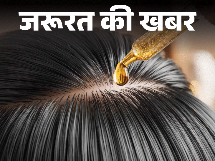 जरूरत की खबर- क्या बालों में ऑयलिंग से बढ़ता डैंड्रफ:  क्या है सही तरीका, हेयर प्रोटेक्शन के 12 टिप्स, बता रहे हैं डर्मेटोलॉजिस्ट