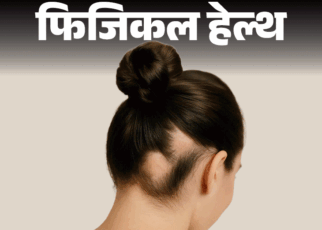 फिजिकल हेल्थ- क्या अचानक झड़ रहे हैं बाल:  हो सकता है एलोपेशिया, जानें क्या है ये ऑटोइम्यून बीमारी, क्या है इसका इलाज