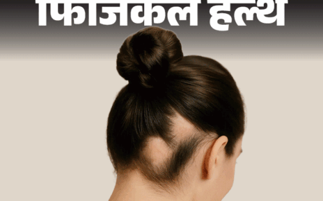 फिजिकल हेल्थ- क्या अचानक झड़ रहे हैं बाल:  हो सकता है एलोपेशिया, जानें क्या है ये ऑटोइम्यून बीमारी, क्या है इसका इलाज