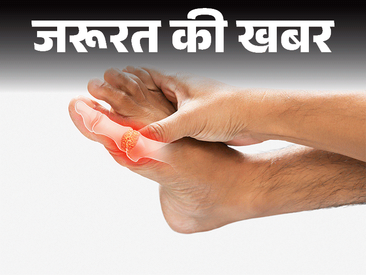 जरूरत की खबर- क्या आपका यूरिक एसिड बढ़ा है: इन 9 संकेतों से पहचानें, जानें बिना दवाई कैसे करें कंट्रोल, क्या खाएं और क्या न खाएं जरूरत की खबर- क्या आपका यूरिक एसिड बढ़ा है: इन 9 संकेतों से पहचानें, जानें बिना दवाई कैसे करें कंट्रोल, क्या खाएं और क्या न खाएं