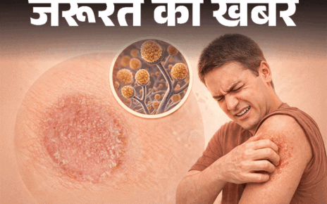 जरूरत की खबर- रिंगवार्म क्या है:  क्या यह संक्रामक हो सकता है, डॉक्टर से जानें फैलने का कारण, लक्षण और इलाज, न करें ये 9 गलतियां