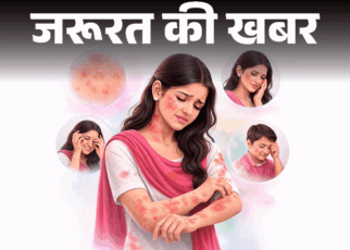 जरूरत की खबर- होली रंगों से स्किन पर रैशेज, दाने:  डर्मेटोलॉजिस्ट से जानें 10 घरेलू इलाज, ये 6 संकेत दिखें तो तुरंत डॉक्टर को दिखाएं