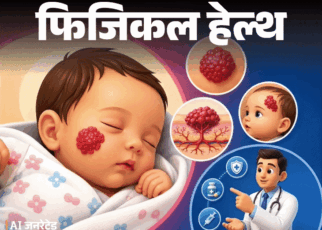 फिजिकल हेल्थ- नवजात शिशु के बर्थमार्क को इग्नोर न करें:  ये हेमेंजियोमा हो सकता है, डॉक्टर से जानें इसके कारण, लक्षण और इलाज