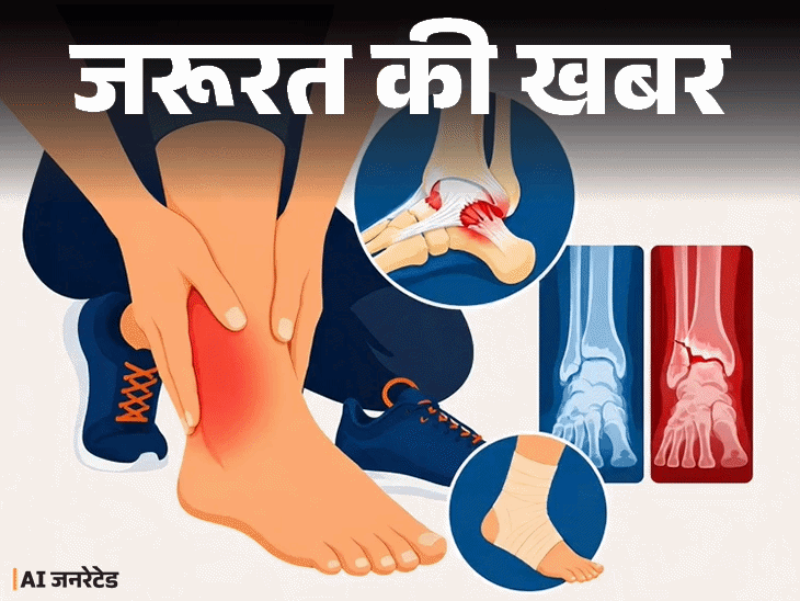 जरूरत की खबर- पैर में मोच आए तो क्या करें:  फॉलो करें RICE थेरेपी, ये 7 संकेत दिखें तो डॉक्टर के पास जाएं, ये 5 गलतियां न करें