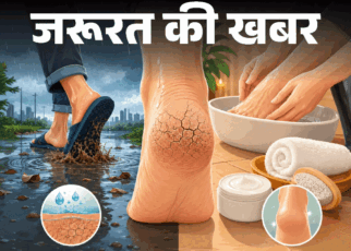 जरूरत की खबर– बारिश में फट रही एड़ियां:  नमी, पानी, गंदगी है कारण, जानें कैसे रखें सुरक्षित, मानसून फुट केयर रूटीन के 8 स्टेप्स