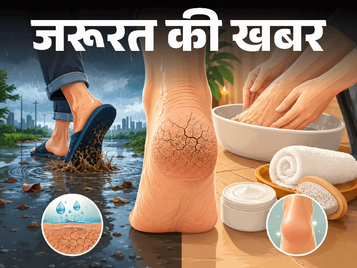 जरूरत की खबर– बारिश में फट रही एड़ियां:  नमी, पानी, गंदगी है कारण, जानें कैसे रखें सुरक्षित, मानसून फुट केयर रूटीन के 8 स्टेप्स