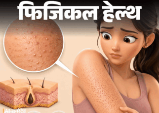 फिजिकल हेल्थ- बांहों पर रेत जैसे बारीक खुरदरे दाने:  ये ‘चिकन स्किन’ हो सकती है, डॉक्टर से समझें इसका कारण, इलाज और बचाव के टिप्स