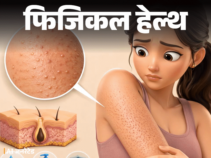 फिजिकल हेल्थ- बांहों पर रेत जैसे बारीक खुरदरे दाने:  ये ‘चिकन स्किन’ हो सकती है, डॉक्टर से समझें इसका कारण, इलाज और बचाव के टिप्स