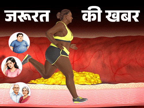 जरूरत की खबर- क्या कोलेस्ट्रॉल सचमुच हमारा दुश्मन है?:  डॉक्टर से समझें गुड-बैड कोलेस्ट्रॉल का साइंस, ये कब जरूरी और कब खतरनाक