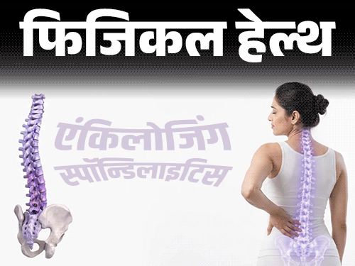 फिजिकल हेल्थ- कमर में दर्द को इग्नोर न करें:  हो सकता है एंकिलोजिंग स्पॉन्डिलाइटिस, डॉक्टर से जानें इसके लक्षण और बचाव के तरीके